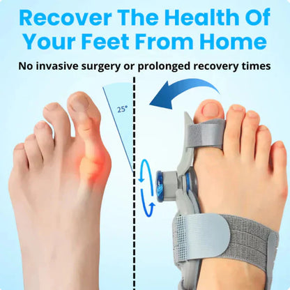 AlignToe Pro™ - Non-Surgical Relief for Bunion Pain