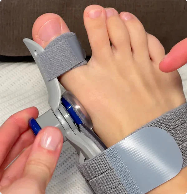 AlignToe Pro™ - Non-Surgical Relief for Bunion Pain